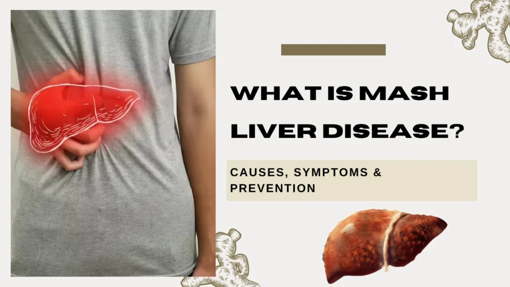 What is MASH Liver Disease? Causes, Symptoms & Prevention What is MASH Liver Disease? Causes, Symptoms & Prevention